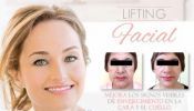 Rejuvenecimiento facial con lifting Clínica Renacer